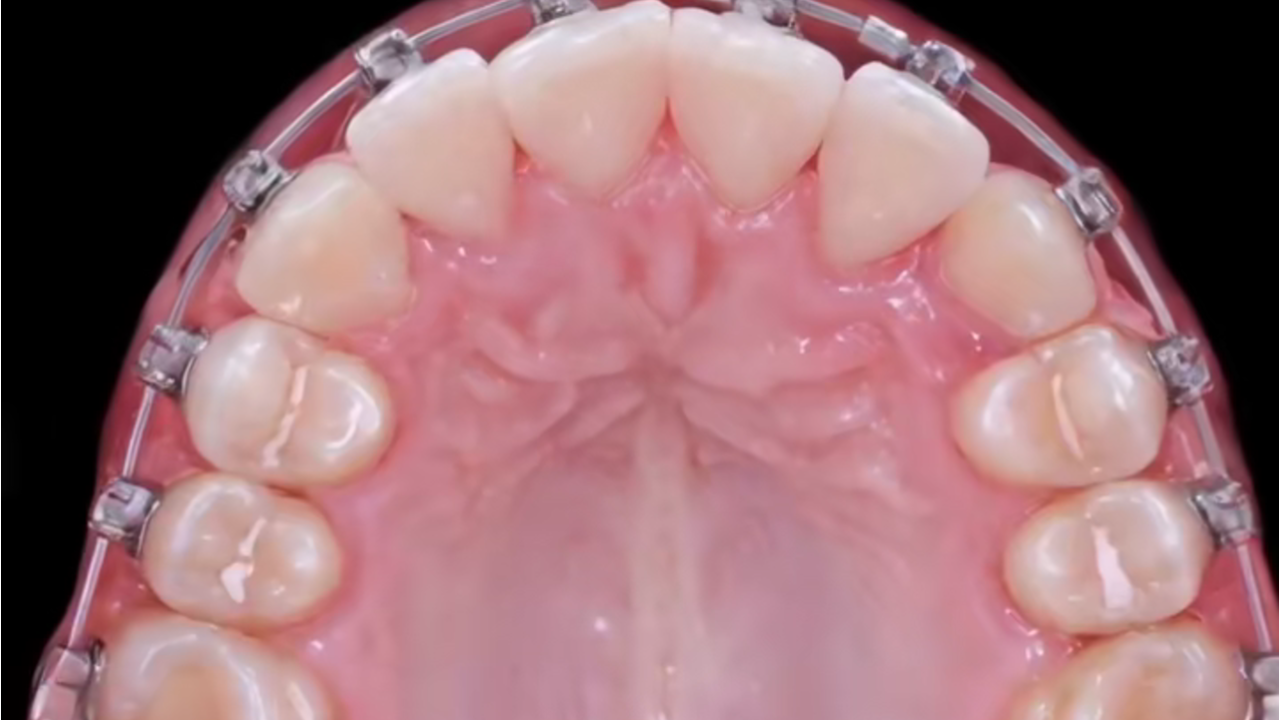 日本の歯科矯正はどこまで進化した？働く世代に適した治療法選び